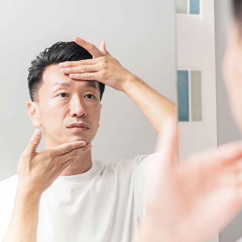 抬頭紋